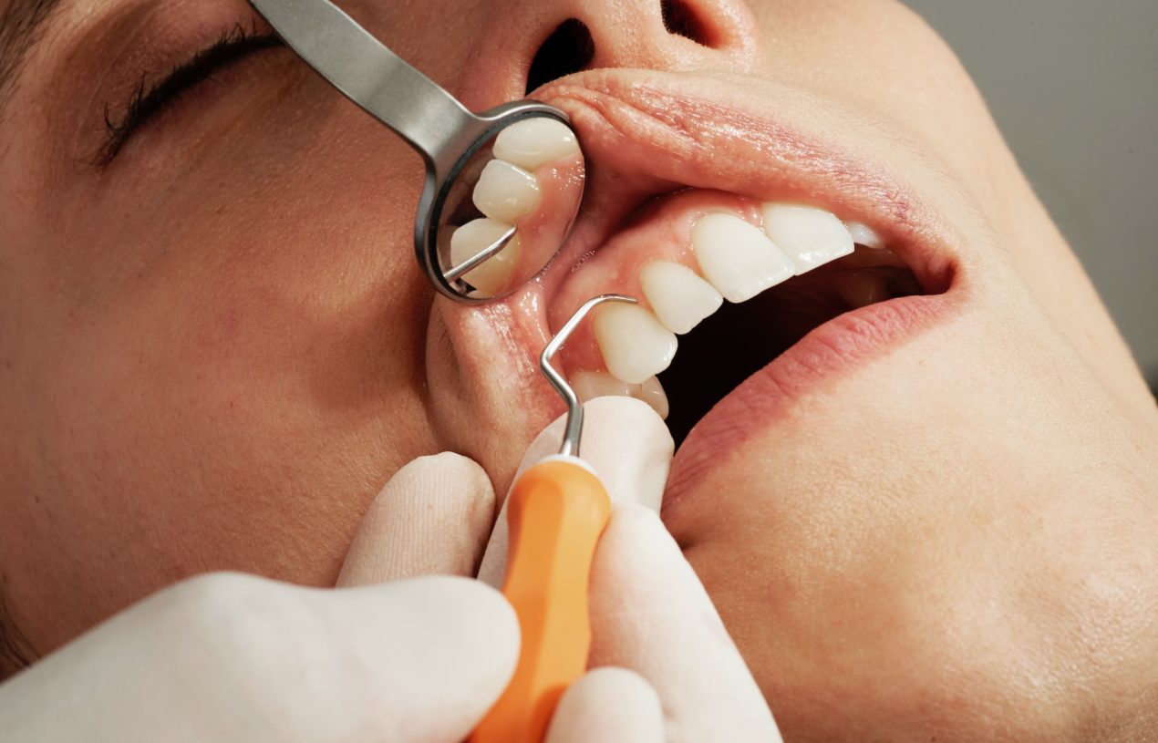 Dentalbegriffe verstehen